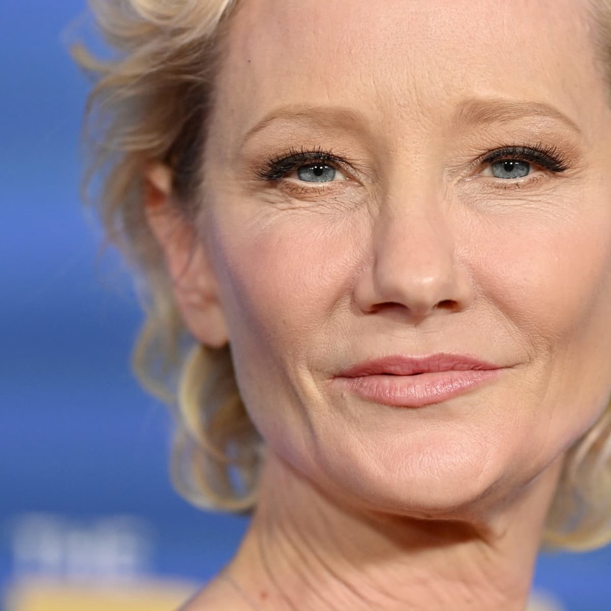 Anne Heche in Stable Condition, Hospitalized After Car Crash